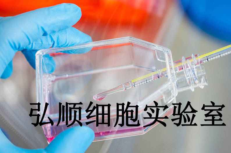 HCC1588 Cells|人肺鳞癌贴壁细胞,HCC1588 Cells