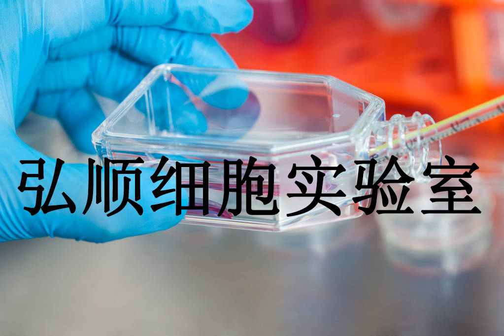 NCI-H128 Cells|人小细胞肺癌贴壁细胞,NCI-H128 Cells