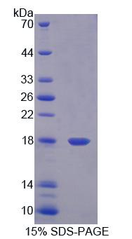 食道癌相关基因4(ECRG4)重组蛋白,Recombinant Esophageal Cancer Related Gene 4 (ECRG4)