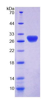 濕結(jié)合蛋白(RTBDN)重組蛋白,Recombinant Retbindin (RTBDN)