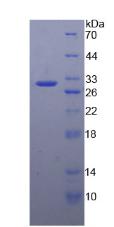 失调蛋白1(ATXN1)重组蛋白,Recombinant Ataxin 1 (ATXN1)