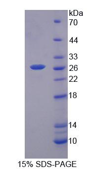 生长抑素受体2(SSTR2)重组蛋白,Recombinant Somatostatin Receptor 2 (SSTR2)
