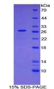 生長(zhǎng)停滯特異性蛋白2(GAS2)重組蛋白,Recombinant Growth Arrest Specific Protein 2 (GAS2)