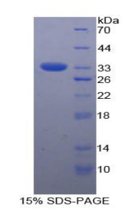 生长激素受体(GHR)重组蛋白,Recombinant Growth Hormone Receptor (GHR)