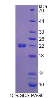 生長激素2(GH2)重組蛋白,Recombinant Growth Hormone 2 (GH2)