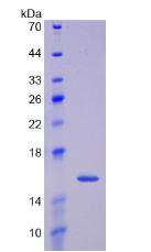 生长分化因子15(GDF15)重组蛋白,Recombinant Growth Differentiation Factor 15 (GDF15)