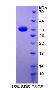 肾素结合蛋白(RENBP)重组蛋白,Recombinant Renin Binding Protein (RENBP)