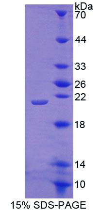 肾上腺皮质发育不良同源物(ACD)重组蛋白,Recombinant Adrenocortical Dysplasia Homolog (ACD)