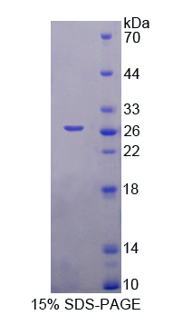 肾母细胞瘤过表达基因(NOV)重组蛋白,Recombinant Nephroblastoma Overexpressed Gene (NOV)