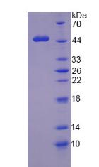 肾母细胞瘤蛋白1(WT1)重组蛋白,Recombinant Wilms Tumor Protein (WT1)