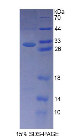 肾结核蛋白2(NPHP2)重组蛋白,Recombinant Nephronophthisis 2, Infantile (NPHP2)