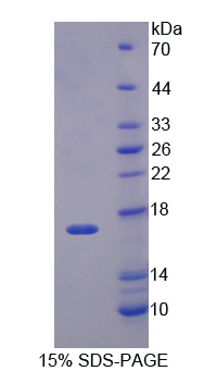 神经元衍生孤儿素受体1(NOR1)重组蛋白,Recombinant Neuron Derived Orphan Receptor 1 (NOR1)