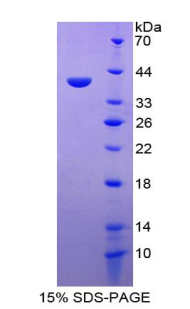 神經(jīng)調(diào)節(jié)素4(NRG4)重組蛋白,Recombinant Neuregulin 4 (NRG4)