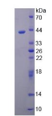 神经鞘胚素(ARTN)重组蛋白,Recombinant Artemin (ARTN)