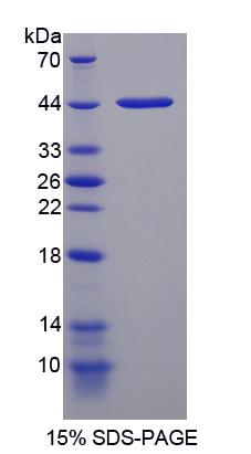 神经介素U(NMU)重组蛋白,Recombinant Neuromedin U (NMU)