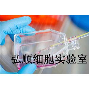 HCC1588 Cells|人肺鳞癌贴壁细胞,HCC1588 Cells