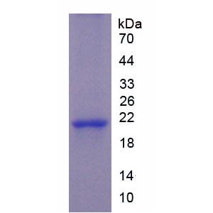 食欲素(OX)重组蛋白,Recombinant Orexin (OX)