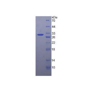 失调蛋白1(ATXN1)重组蛋白