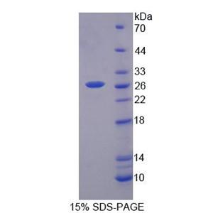 生长抑素受体2(SSTR2)重组蛋白,Recombinant Somatostatin Receptor 2 (SSTR2)