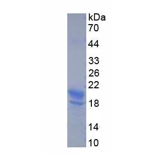 生長抑素(SST)重組蛋白,Recombinant Somatostatin (SST)