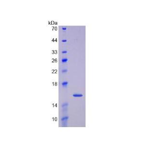 生长分化因子15(GDF15)重组蛋白