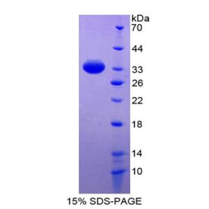 肾素结合蛋白(RENBP)重组蛋白,Recombinant Renin Binding Protein (RENBP)