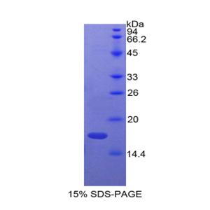 肾上腺髓质素(ADM)重组蛋白