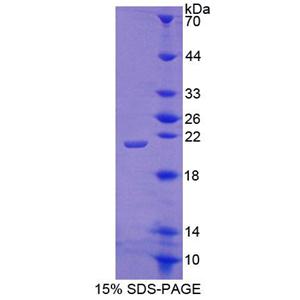 肾上腺皮质发育不良同源物(ACD)重组蛋白