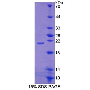 肾上腺皮质发育不良同源物(ACD)重组蛋白,Recombinant Adrenocortical Dysplasia Homolog (ACD)