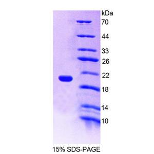 神经纤维网蛋白1(NRP1)重组蛋白,Recombinant Neuropilin 1 (NRP1)