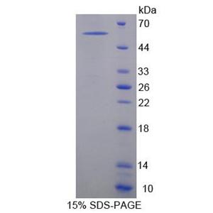 神经外营养蛋白1(NXPH1)重组蛋白,Recombinant Neurexophilin 1 (NXPH1)