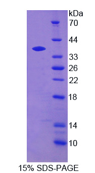 神经蛋白聚糖(NCAN)重组蛋白,Recombinant Neurocan (NCAN)