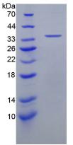 上皮中性粒细胞激活肽78(ENA78)重组蛋白,Recombinant Epithelial Neutrophil Activating Peptide 78 (ENA78)