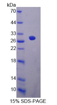 上皮基质相互作用蛋白1(EPSTI1)重组蛋白,Recombinant Epithelial Stromal Interaction 1, Breast (EPSTI1)