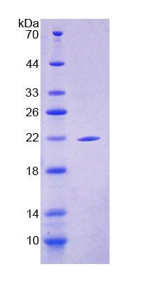 上池蛋白(SBSN)重组蛋白,Recombinant Suprabasin (SBSN)