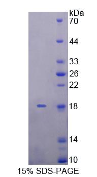 杀伤细胞凝集素样受体亚家族K成员1(KLRK1)重组蛋白,Recombinant Killer Cell Lectin Like Receptor Subfamily K, Member 1 (KLRK1)