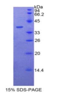 杀菌性/通透性增加蛋白(BPI)重组蛋白,Recombinant Bactericidal/Permeability Increasing Protein (BPI)