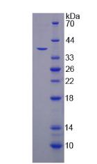 三肽基肽酶Ⅰ(TPP1)重組蛋白,Recombinant Tripeptidyl Peptidase I (TPP1)