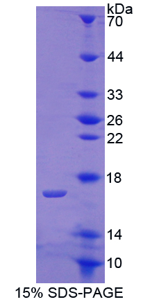 軟骨寡聚基質(zhì)蛋白(COMP)重組蛋白,Recombinant Cartilage Oligomeric Matrix Protein (COMP)