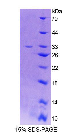 乳糖酶(LCT)重组蛋白,Recombinant Lactase (LCT)