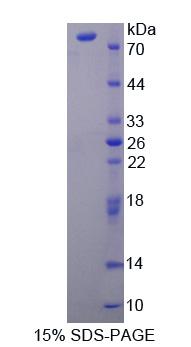 肉毒碱棕榈酰基转移酶2(CPT2)重组蛋白,Recombinant Carnitine Palmitoyltransferase 2, Mitochondrial (CPT2)