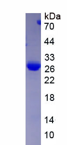 溶质载体家族30成员8(SLC30A8)重组蛋白,Recombinant Solute Carrier Family 30 Member 8 (SLC30A8)