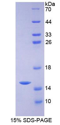 溶质载体家族30成员5(SLC30A5)重组蛋白,Recombinant Solute Carrier Family 30, Member 5 (SLC30A5)