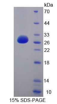 溶血磷脂酶Ⅰ(LYPLA1)重组蛋白,Recombinant Lysophospholipase I (LYPLA1)