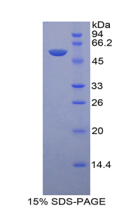 溶酶体关联膜蛋白1(LAMP1)重组蛋白,Recombinant Lysosomal Associated Membrane Protein 1 (LAMP1)