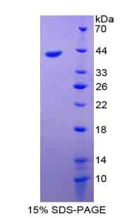 絨毛蛋白1(VIL1)重組蛋白,Recombinant Villin (VIL)