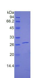 妊娠相关血浆蛋白A2(PAPPA2)重组蛋白,Recombinant Pappalysin 2 (PAPPA2)