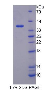 妊娠特异性β1-糖蛋白2(PSG2)重组蛋白,Recombinant Pregnancy Specific Beta-1-Glycoprotein 2 (PSG2)