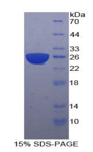 妊娠特異性β1-糖蛋白(PSG1)重組蛋白,Recombinant Pregnancy Specific Beta-1-Glycoprotein 1 (PSG1)