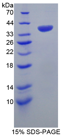 熱休克轉(zhuǎn)錄因子4(HSF4)重組蛋白,Recombinant Heat Shock Transcription Factor 4 (HSF4)